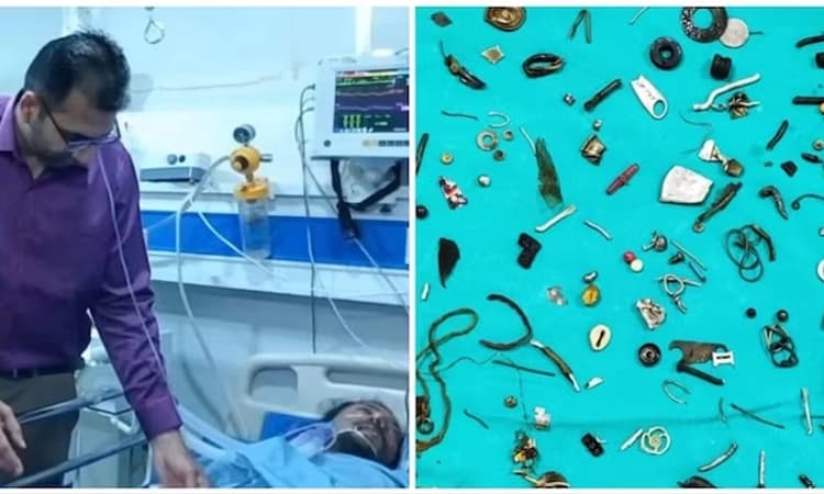 Miracle: ಈ ರೋಗಿಯ ಹೊಟ್ಟೆಯಲ್ಲಿತ್ತು ನಟ್, ಬೋಲ್ಟ್ ಸೇರಿ 15 ಕ್ಕೂ ಹೆಚ್ಚು ವಸ್ತುಗಳು…