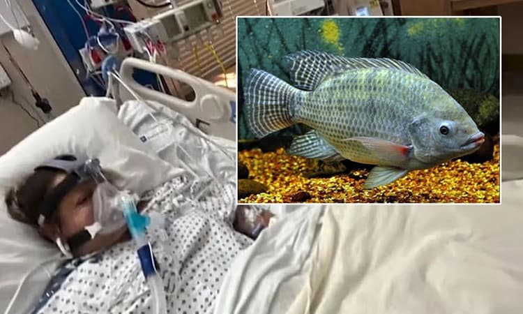 Tilapia Fish: ಮೀನು ತಿಂದು ಕೈ, ಕಾಲುಗಳನ್ನೇ ಕಳೆದುಕೊಂಡ ಮಹಿಳೆ… ಎಚ್ಚರ ಅಗತ್ಯ