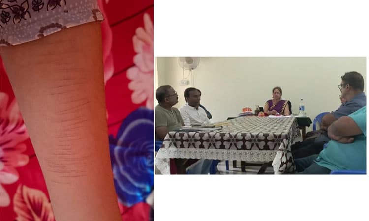 Dandeli: ವಿದ್ಯಾರ್ಥಿನಿಯರು ಸಾಮೂಹಿಕವಾಗಿ ಕೈಗೆ ಬರೆ ಎಳೆದುಕೊಂಡ ಪ್ರಕರಣ; ಪೊಲೀಸ್‌ ವಿಚಾರಣೆ