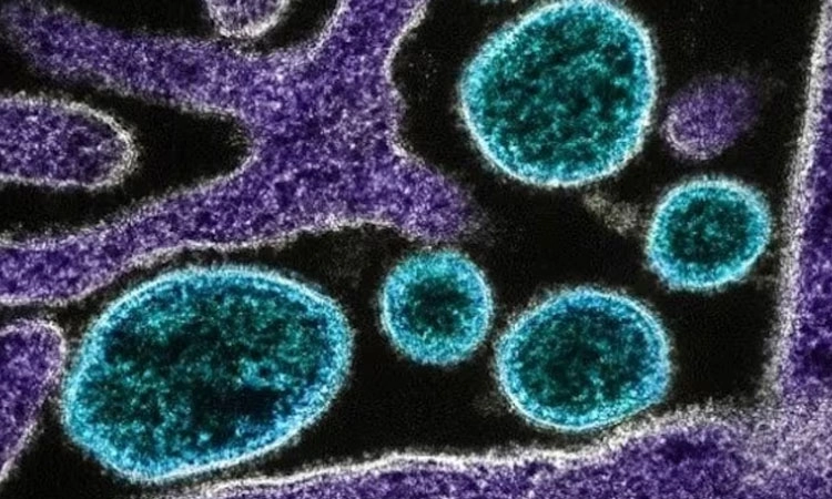 Nipah alert: ಕೇರಳದಲ್ಲಿ ಇಬ್ಬರ ಅಸಹಜ ಸಾವು: ನಿಫಾ ವೈರಸ್‌ ಶಂಕೆ