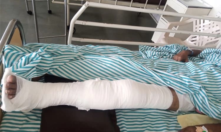 Dandeli; ದ್ವಿಚಕ್ರ ವಾಹನ ಮತ್ತು ಕಾರು ಢಿಕ್ಕಿ: ಓರ್ವ ಗಂಭೀರ