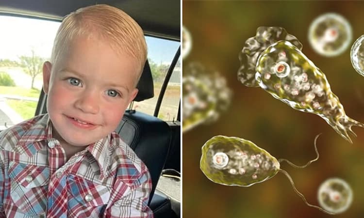 Brain-Eating Amoeba: ಮೆದುಳು ತಿನ್ನುವ ಅಮೀಬಾಗೆ 2 ವರ್ಷದ ಮಗು ಮೃತ್ಯು