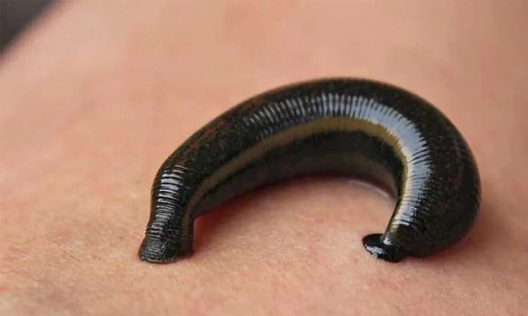 Leech: ಸದ್ದಿಲ್ಲದೇ ನೆತ್ತರು ಹೀರುವ ಮಹಾಶಯ