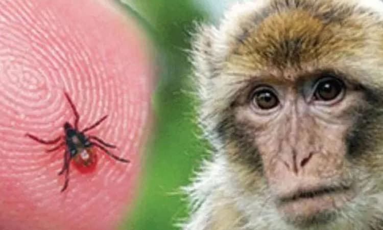 Shimoga; ಮಂಗನ ಕಾಯಿಲೆಗೆ 18 ವರ್ಷದ ಯುವತಿ ಸಾವು