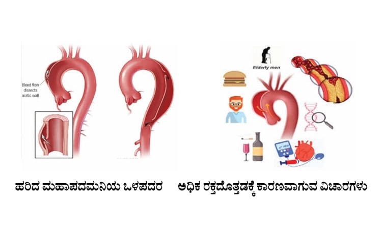 High Blood Pressure: ಅಧಿಕ ರಕ್ತದೊತ್ತಡ (ಹೈ ಬಿಪಿ) ಖಂಡಿತವಾಗಿಯೂ ನಿರ್ಲಕ್ಷ್ಯ ಬೇಡ!