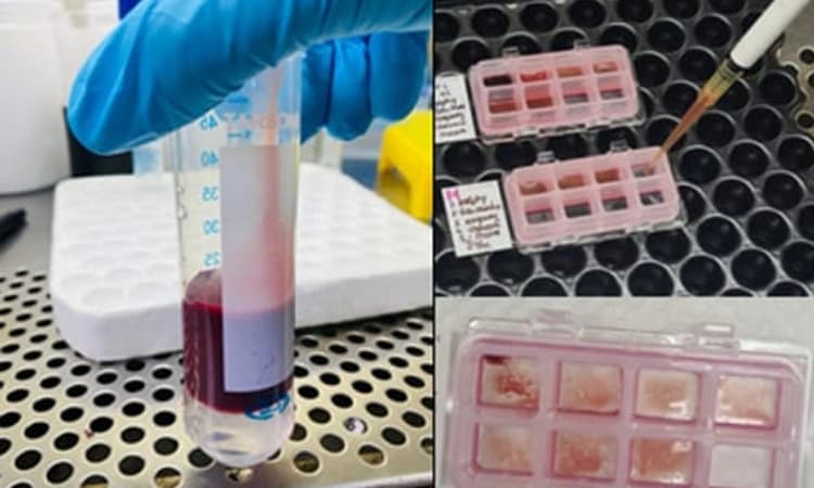 KMC Manipal: ಸಂಕೀರ್ಣ ಹೊಂದಾಣಿಕೆಯಾಗದ ರಕ್ತದ ಸುರಕ್ಷಿತ ವರ್ಗಾವಣೆಗಾಗಿ MMA