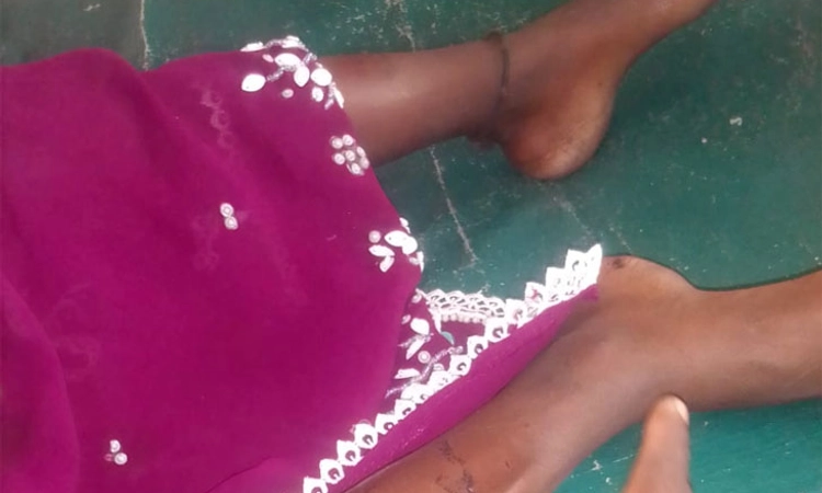 Raichur: ಬಾಲಕಿ ಮೇಲೆ ಹಂದಿ ಮಾರಣಾಂತಿಕ ದಾಳಿ