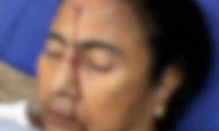 West Bengal ಸಿಎಂ ಮಮತಾ ಬ್ಯಾನರ್ಜಿ ಅವರಿಗೆ ಗಂಭೀರ ಗಾಯ: ಆಸ್ಪತ್ರೆಗೆ ದಾಖಲು