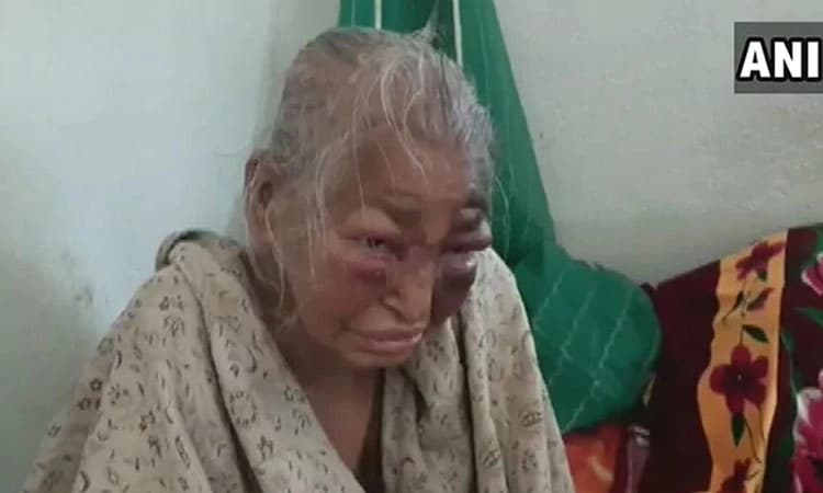 ತಾಯಿಯ ಮೇಲೆ ಟಿ ಎಮ್ ಸಿ ಗೂಂಡಾಗಳಿಂದ ಹಲ್ಲೆ : ಬಿಜೆಪಿ ಕಾರ್ಯಕರ್ತನಿಂದ ಆರೋಪ