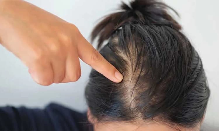 ಕೇಶ ಸೌಂದರ್ಯಕ್ಕೆ ಇಲ್ಲಿದೆ ಸುಲಭ ನೈಸರ್ಗಿಕ ಮನೆಮದ್ದು