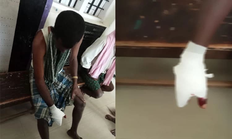 ಮಧುಗಿರಿ: ರೈತನ ಮೇಲೆ ಕರಡಿ ದಾಳಿ