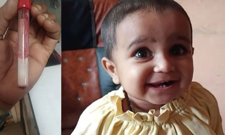 ಈ ಮಗುವಿನ ದೇಹದಲ್ಲಿರುವುದು ಬಿಳಿ ರಕ್ತ…ಸ್ಯಾಂಪಲ್‌ ಕಂಡ ವೈದ್ಯರು ಶಾಕ್‌…