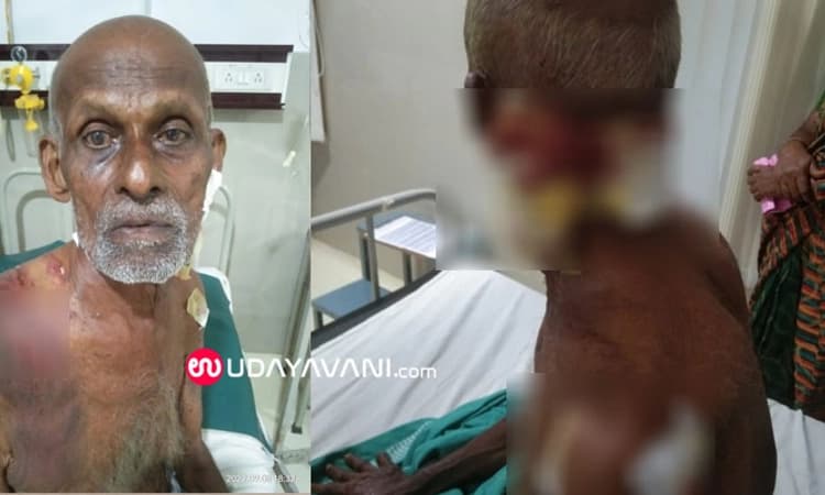 ಕಾರ್ಕಳ: ಮುಂಡ್ಕೂರು ಗ್ರಾಮದಲ್ಲಿ ವೃದ್ಧರ ಮೇಲೆ ಚಿರತೆ ದಾಳಿ