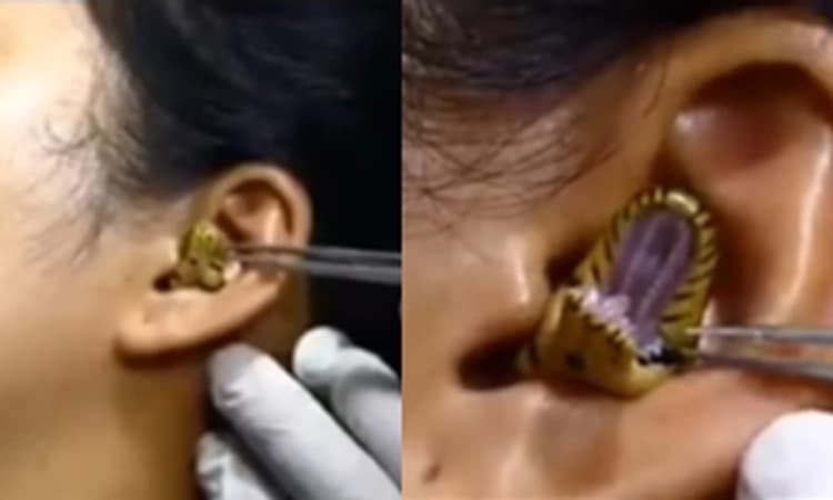 ಯುವತಿಯ ಕಿವಿಯೊಳಗೆ ಹಾವು ? ನಂಬಲು ಅಸಾಧ್ಯ.. ಆದರೂ ಸತ್ಯ !