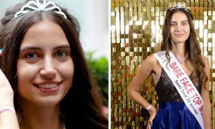 ಲಂಡನ್‌: ಮಿಸ್ ಇಂಗ್ಲೆಂಡ್ ಗೆ ಮೇಕಪ್ ಇಲ್ಲದೆ ಸ್ಪರ್ಧಿಸಿದ ಮೊದಲ ಸ್ಪರ್ಧಿ