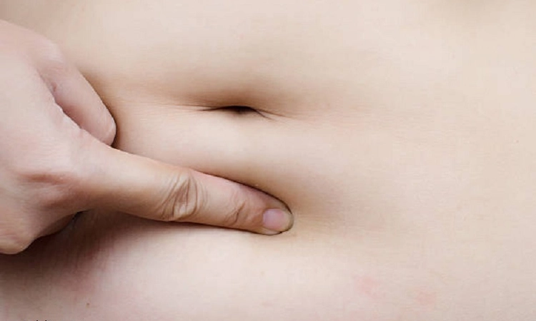 Innies, outies and omphalophobia: 7 navel-gazing questions about belly buttons answered