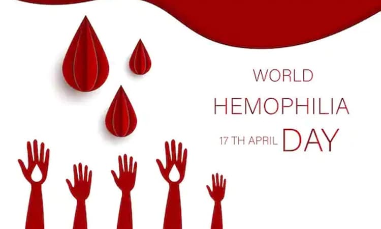 World Hemophilia Day: India has the second highest number of Hemophilia cases in the world