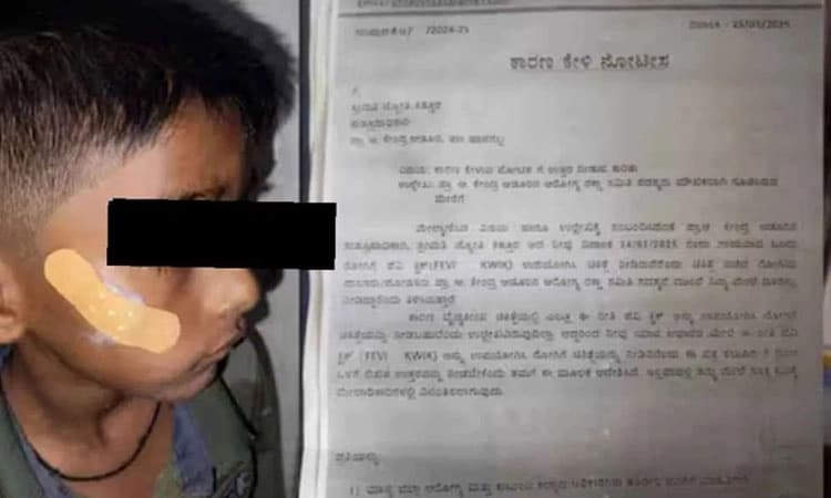 Haveri: Nurse allegedly applies instant adhesive instead of stitches on injured boy!