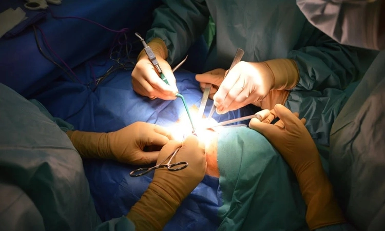 Doctors save 11-year-old by performing rare diaphragmatic hernia surgery at Jaipur hospital