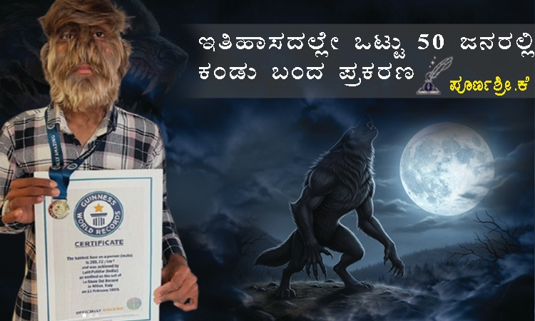Werewolf syndrome– ಅಪರೂಪದ ಕಾಯಿಲೆಯಿಂದ ಗಿನ್ನೆಸ್ ವಿಶ್ವ ದಾಖಲೆ ಮಾಡಿದ 18ರ ಯುವಕ