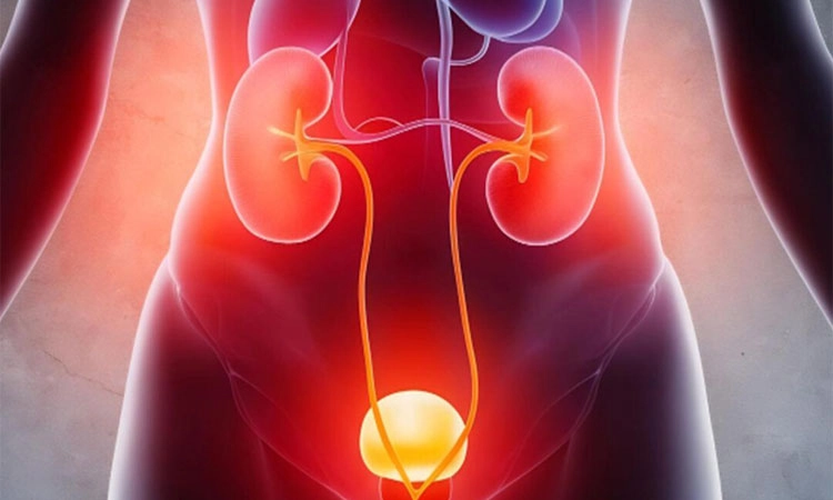 Urinary Tract Infection: ಮೂತ್ರನಾಳದ ಸೋಂಕು; ತಡೆಯಬಹುದಾದ ಆರೋಗ್ಯ ಸಮಸ್ಯೆ