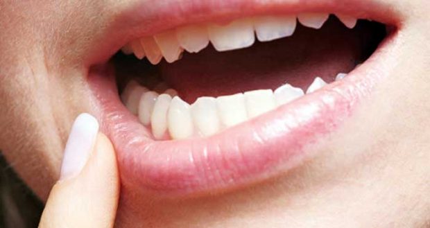 Pain-Sensitive-Gums-730×272.jpg