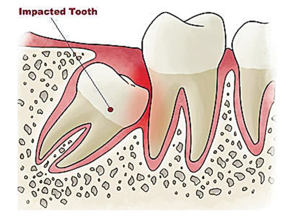 TOOTH