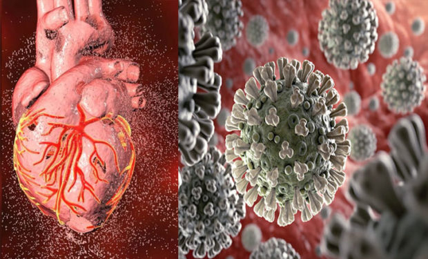 ಹೃದಯಕ್ಕೂ ಕೋವಿಡ್ 19ಕ್ಕೂ ಇದೆಯೇ ನಿಕಟ ನಂಟು?