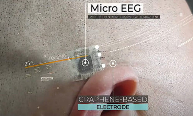 Brain E-Tattoo: Subcutaneous Implantable EEG Electrode is a minimally invasive 4 channel implant designed for long-term monitoring to detect epileptic seizures.