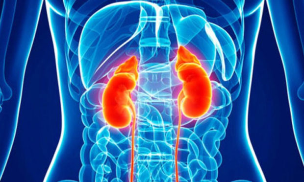 Kidney Stone: Here’s a simple solution