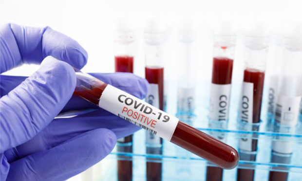 India’s first COVID-19 patient tests positive again