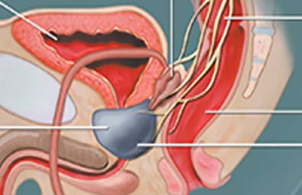 Health tips; ಪ್ರಾಸ್ಟ್ರೇಟ್‌ ಗ್ರಂಥಿಯಿಂದಾಗಿ ಮೂತ್ರಾಂಗ ಸಮಸ್ಯೆಗಳು