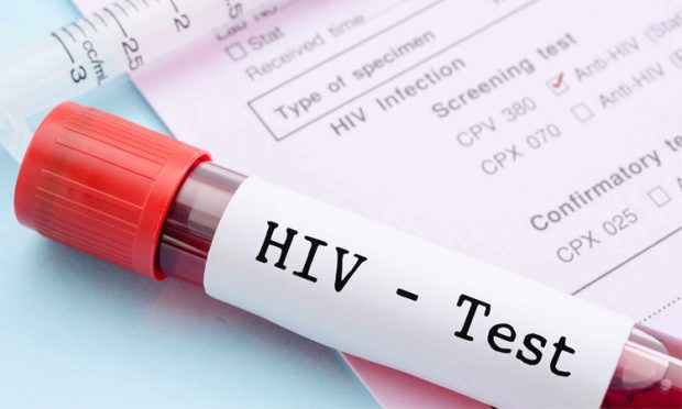 1-hiv-test