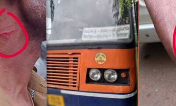 Bus Ticket ವಿಚಾರದಲ್ಲಿ ತಗಾದೆ: ಬಸ್‌ ನಿರ್ವಾಹಕನಿಗೆ ಪರಚಿ ಹಲ್ಲೆ ನಡೆಸಿದ ಪ್ರಯಾಣಿಕ