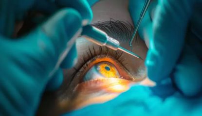 Eye Surgeries: ಪದವಿ ಪೂರ್ಣಗೊಳಿಸದೆ 44 ಕಣ್ಣಿನ ಶಸ್ತ್ರಚಿಕಿತ್ಸೆ ನಡೆಸಿದ ವೈದ್ಯ…